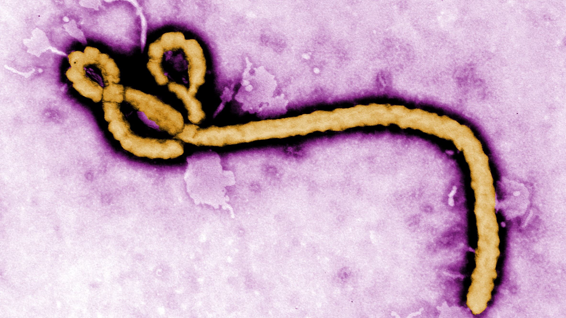 Rob Fowler MD and His Contributions to Ebola Virus Disease Part 1